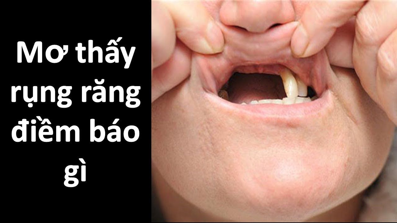 mơ thấy rụng răng